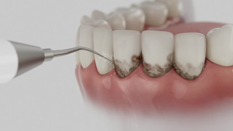 Reliable Teeth Whitening contractor in Bannock County County, ID by Dentist Open Now
